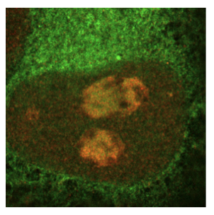 Microscopic picture of nucleoli with CHIP and HSP70 inside